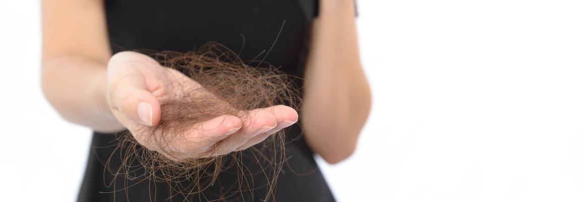 Hormonális egyensúlyhiány okozhat hajhullást a nőknél