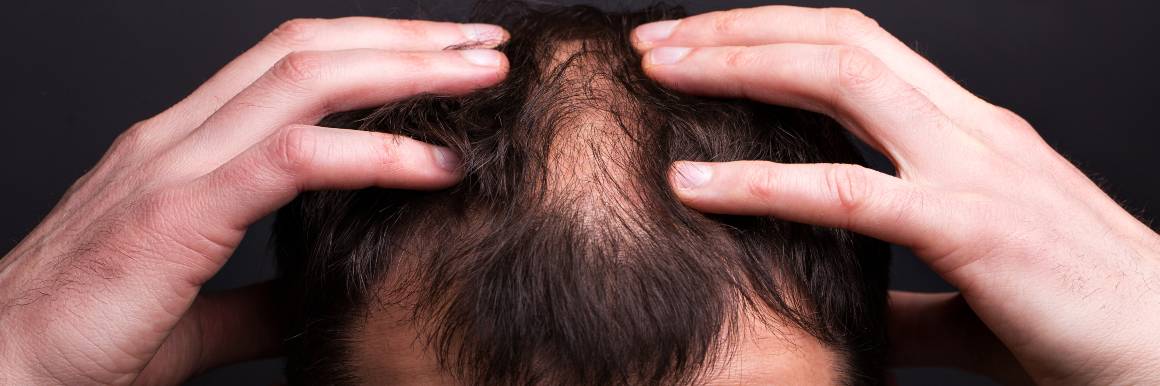 A sérült hajhagymák helyreállítása az egészséges hajnövekedés érdekében